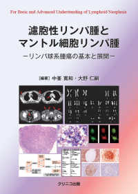 濾胞性リンパ腫とマントル細胞リンパ腫　リンパ球系腫瘍の基本と展開
